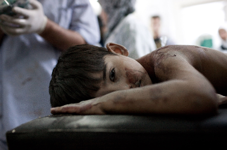 syria enfant blesse